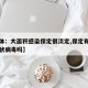 【媒体：大面积感染保定很淡定,保定有人感染冠状病毒吗】