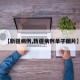 【新疆病例,新疆病例单子图片】